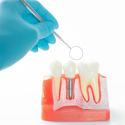 About Dental Tourism and Dentists in Los Algodones with A Gutierrez from Sani Dental Mexico